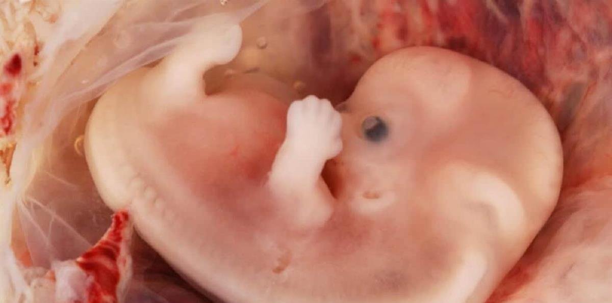 Gobernadora de PR firma enmienda al Código Penal que reconoce fetos como seres humanos