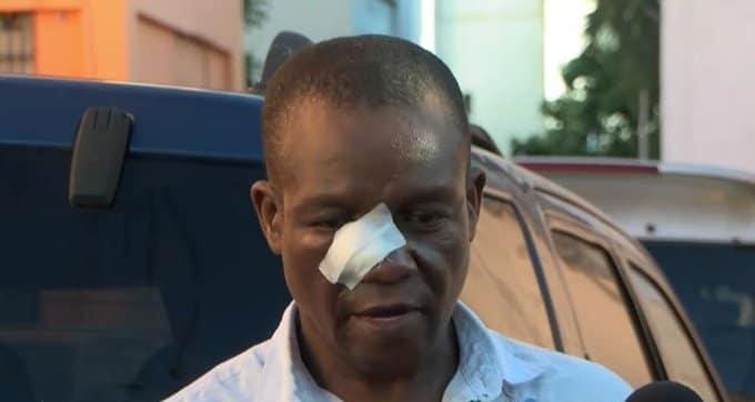 Maestro denuncia que fue atacado con sillas y piedras por dos estudiantes en Liceo Juan Pablo Duarte