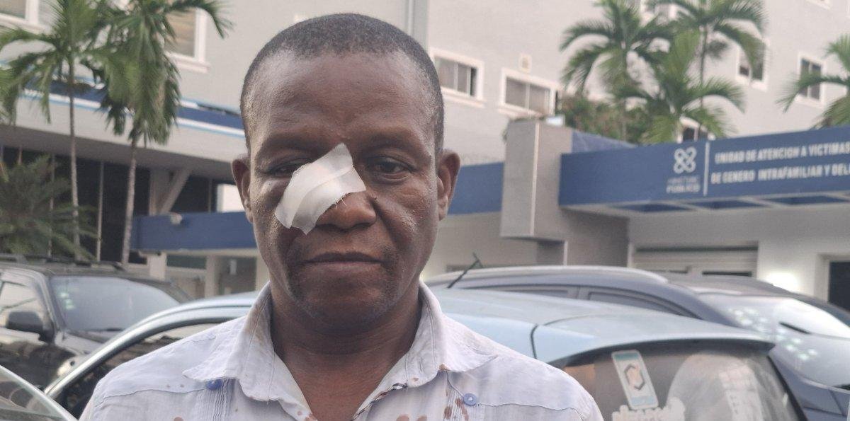 Iba a impartir su clase en Liceo Juan Pablo Duarte, pero estudiantes lo golpearon hasta dejarlo sangrando