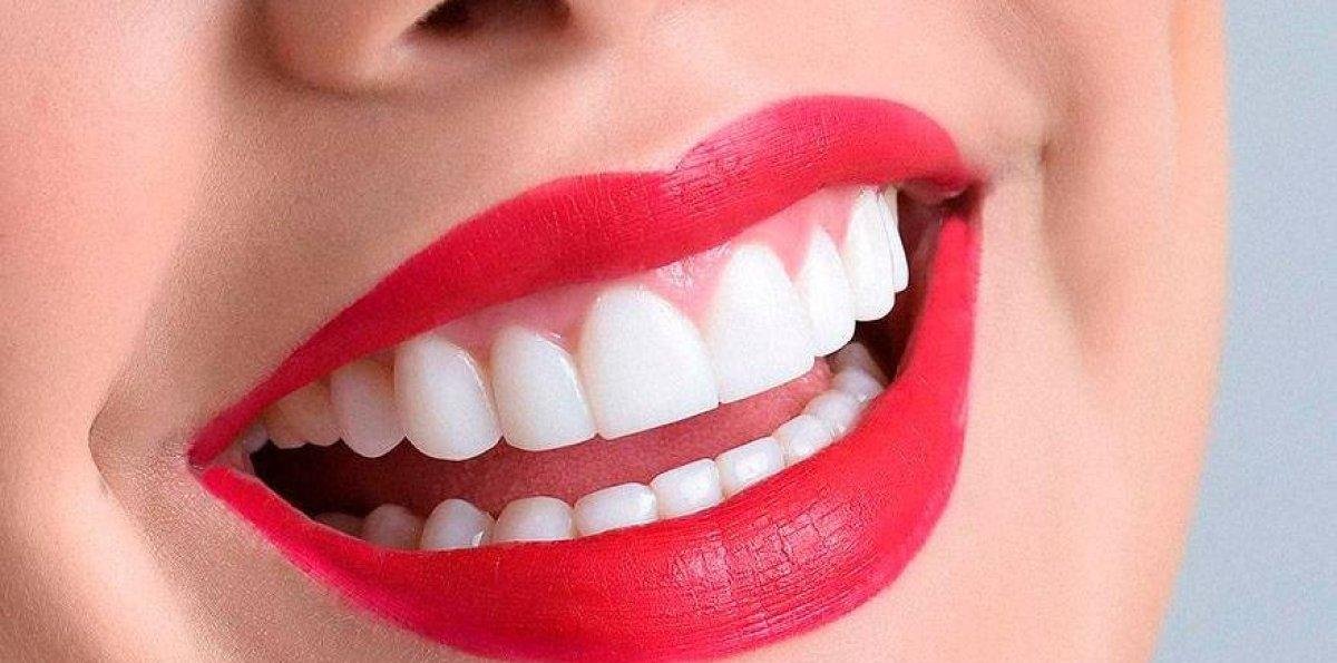 Cuidar tu sonrisa es amor