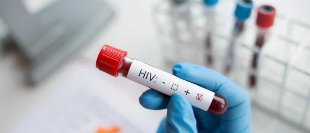 Más de 16,000 personas con VIH perderían su tratamiento en Florida por un recorte público