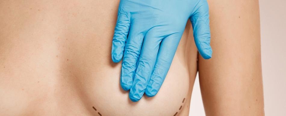 ¿Cuáles son las cirugías estéticas que están “en tendencia” en República Dominicana?