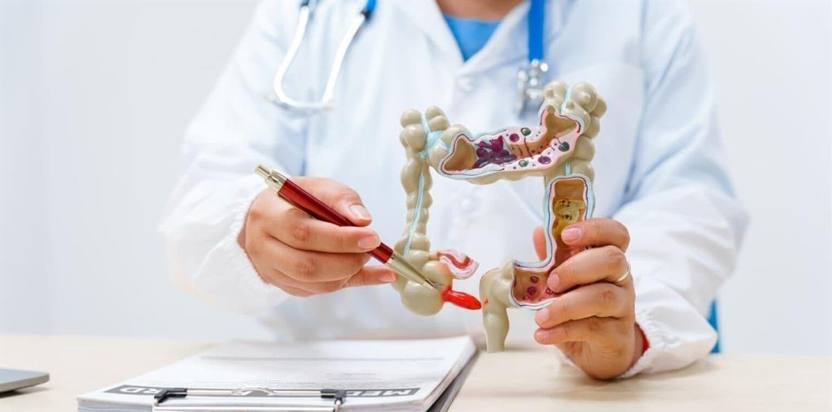 El cáncer de colon es una enfermedad silenciosa que, muchas veces, puede prevenirse