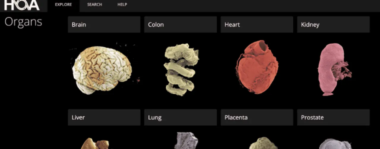 El "google earth" de los órganos permite una perspectiva inigualable del cuerpo humano