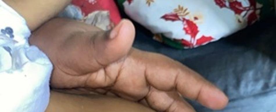 La niña Jaronny Rodríguez necesita trasplante de hígado urgente